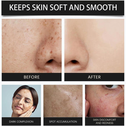 Crema OUHOE 345 Relief Cream 50g / 1.76 oz